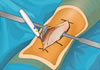 Virtual Surgery